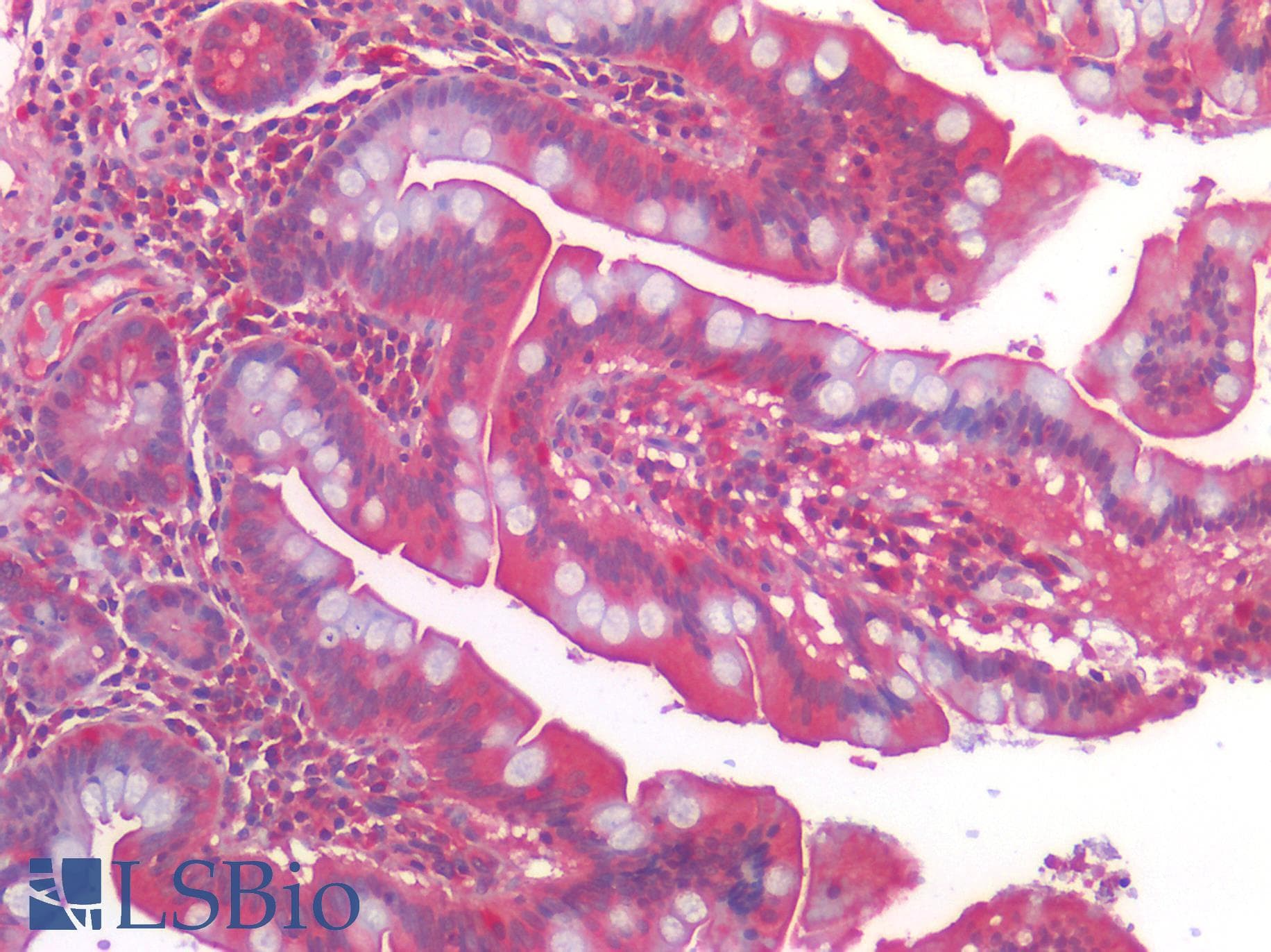 PathPlus™ CALCRL / CGRP Receptor Antibody (Cytoplasmic Domain)