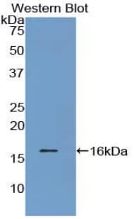 TTR / Transthyretin Antibody (aa12-126)