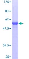 Human SCEH / ECHS1 Protein (Recombinant GST)