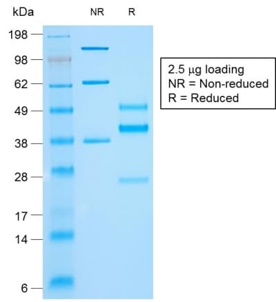 Recombinant Monoclonal Mouse anti-Human KRT10 / CK10 / Cytokeratin 10 Antibody (clone rKRT10/844, IHC)