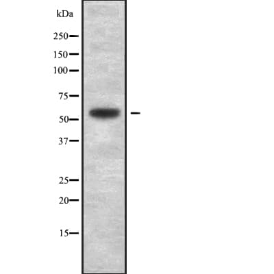 SMARCD1 / BAF60A Antibody