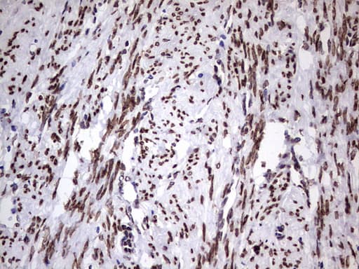 CSNK1E / CK1 Epsilon Antibody (aa153-416, clone OTI5D4)