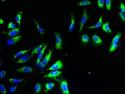 IHC-plus™ CYC1 / Cytochrome C-1 Antibody