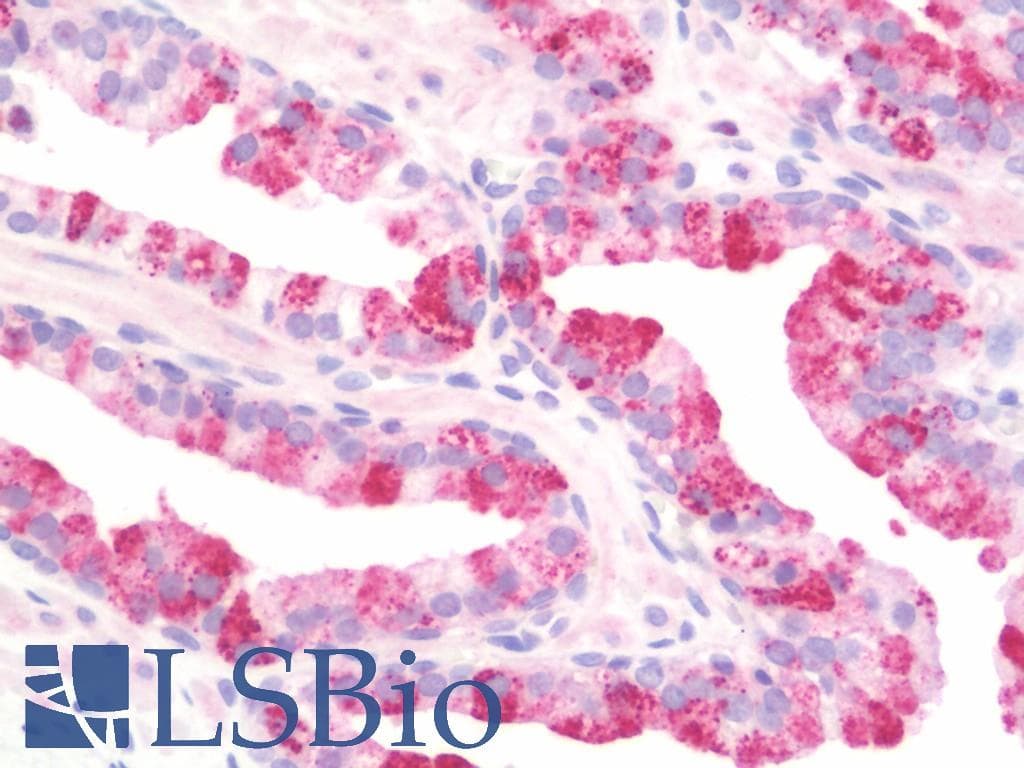 IHC-plus™ USP51 Antibody (aa278-307)