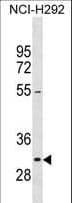 Polyclonal Rabbit anti-Human NIFK / MKI67IP Antibody (aa232-260, WB)
