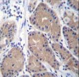 Polyclonal Rabbit anti-Human CA1 / Carbonic Anhydrase I Antibody (aa60-90, IHC, WB)