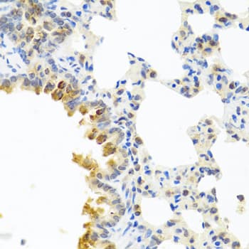 Alpha-1-Antichymotrypsin Antibody