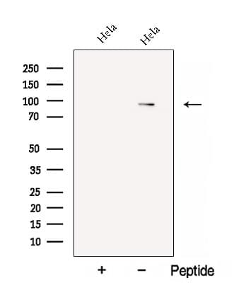 Polyclonal Rabbit anti-Human HID1 / C17orf28 Antibody (WB)