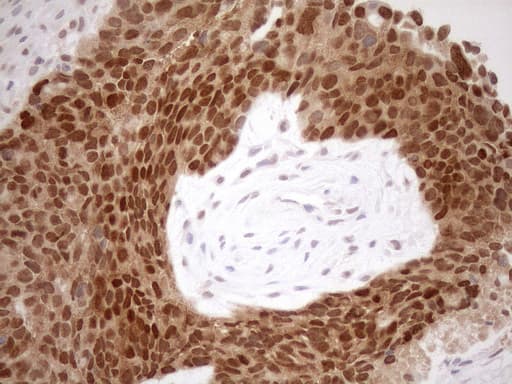 Monoclonal Mouse anti-Human MGMT Antibody (clone OTI2F10, IHC, WB)