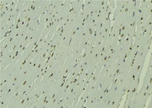 ZNHIT1 Antibody
