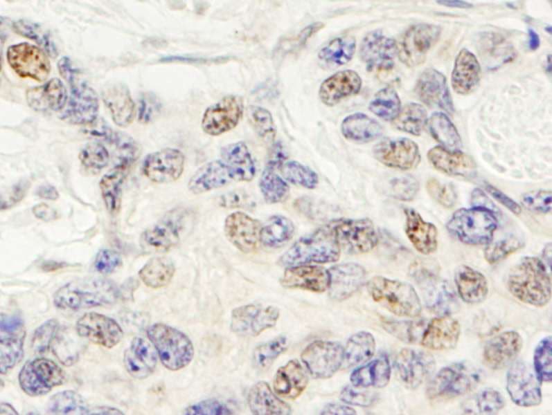 ZNF592 Antibody (aa950-1000)
