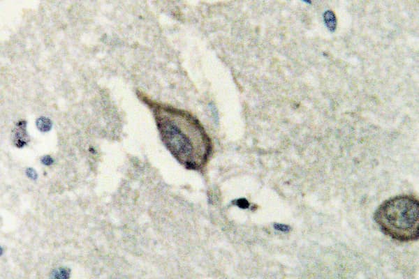 EPHB6 / EPH Receptor B6 Antibody (Asp881)