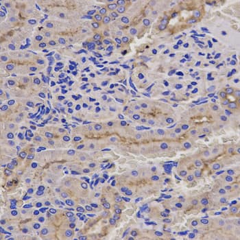 Polyclonal Rabbit anti-Human PRF1 / Perforin Antibody (IHC, IF, WB)