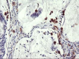SDS Antibody (clone OTI4C3)