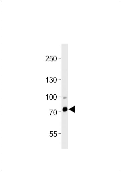 Polyclonal Rabbit anti-Human ZFP219 / ZNF219 Antibody (aa154-183, IHC, WB)