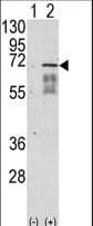 PathPlus™ Polyclonal Rabbit anti-Human ALK2 / ACVR1 Antibody (aa138-170, IHC, WB)