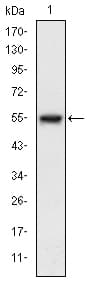 MAP3K5 / ASK1 Antibody (clone 2E4)