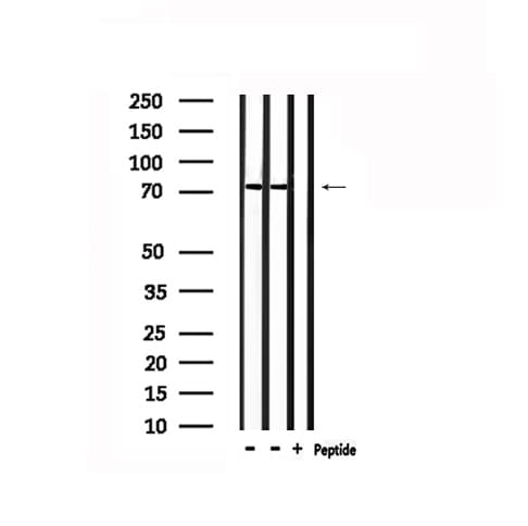 RIP1 / RALBP1 Antibody