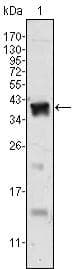 Monoclonal Mouse anti-Human AR / Androgen Receptor Antibody (clone 2H8, IHC, WB)