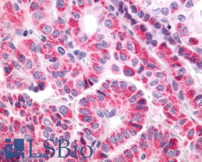 PathPlus™ Polyclonal Rabbit anti-Human TSH Receptor / TSHR Antibody (C-Terminus, IHC)