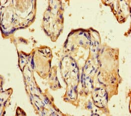 CSF2 / GM-CSF Antibody