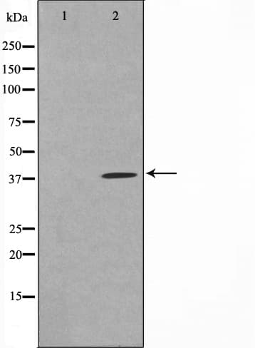 TUSC3 Antibody