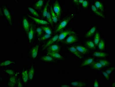 IHC-plus™ MSLN / Mesothelin Antibody (aa 37-598)
