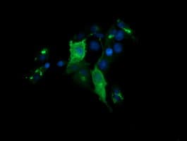 CHGA / Chromogranin A Antibody (clone OTI1B8)