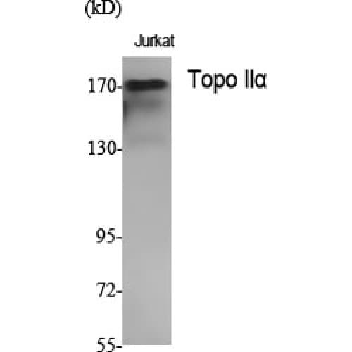 TOP2A / Topoisomerase II Alpha Antibody (1-80 aa, N-terminal)