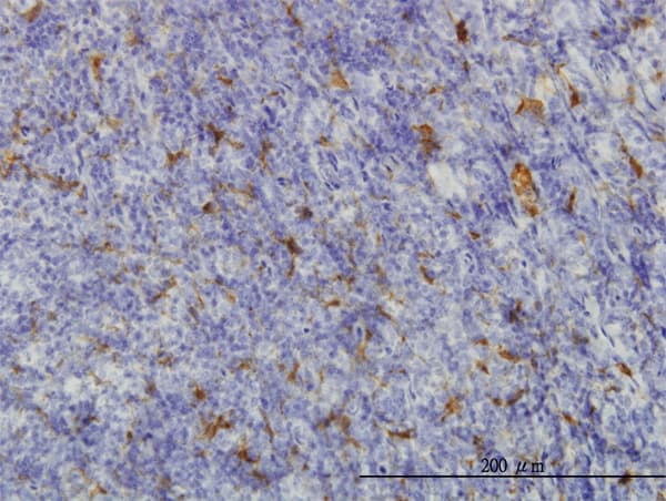 Monoclonal Mouse anti-Human ME1 / Malate Dehydrogenase Antibody (clone 3H5, IHC, WB)
