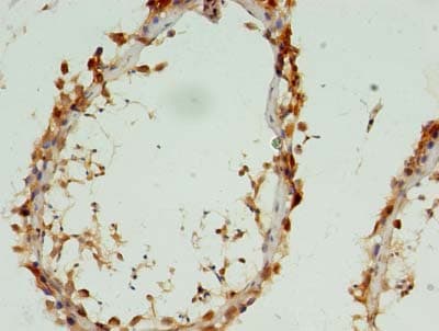 CYTL1 / C17 Antibody