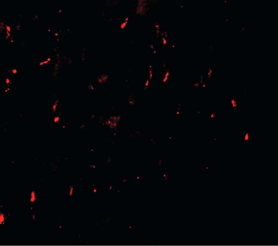 MYT1L Antibody