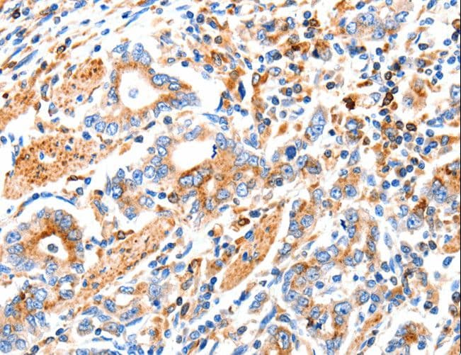 Polyclonal Rabbit anti-Human MAP2K2 / MKK2 / MEK2 Antibody (IHC, WB)
