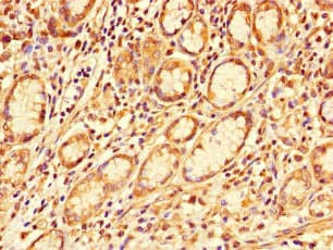 Polyclonal Rabbit anti-Human GALNT11 Antibody (IHC, IF)