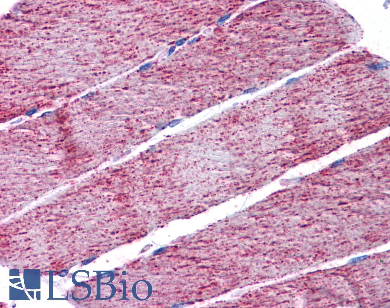 IHC-plus™ FH / Fumarase / MCL Antibody (aa176-189)