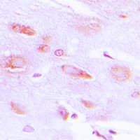 ADRBK1 / GRK2 Antibody (phospho-Ser29)