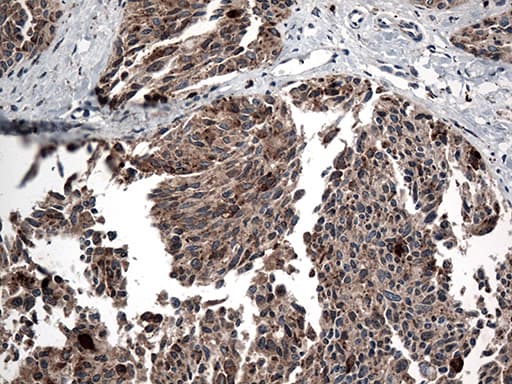 CTSL / Cathepsin L Antibody (aa114-333, clone OTI5C8)