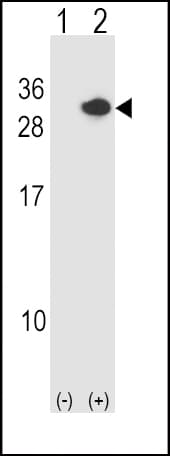 RCAN1 / DSCR1 Antibody (aa41-68)