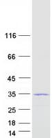Human C19orf81 Protein (Recombinant Myc-DDK (Flag))