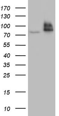 Monoclonal Mouse anti-Human R1 / RRM1 Antibody (clone OTI16A8, aa541-792, IHC, WB)