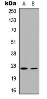 Polyclonal Rabbit anti-Human CDKN1B / p27 Kip1 Antibody (phospho-Thr187, IHC, IF, WB)