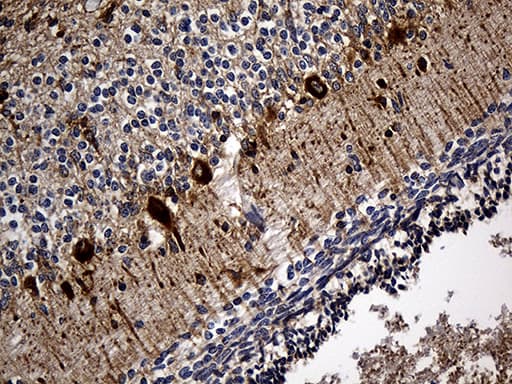 SORL1 Antibody (aa573-753, clone OTI2D5)