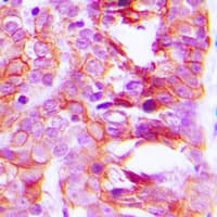 Polyclonal Rabbit anti-Human KCNK15 Antibody (C-Terminus, IHC, WB)