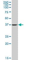 IHC-plus™ ALDOA / Aldolase A Antibody (clone 2E6)