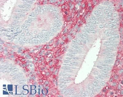VCAN / Versican Antibody (aa2958-3209)