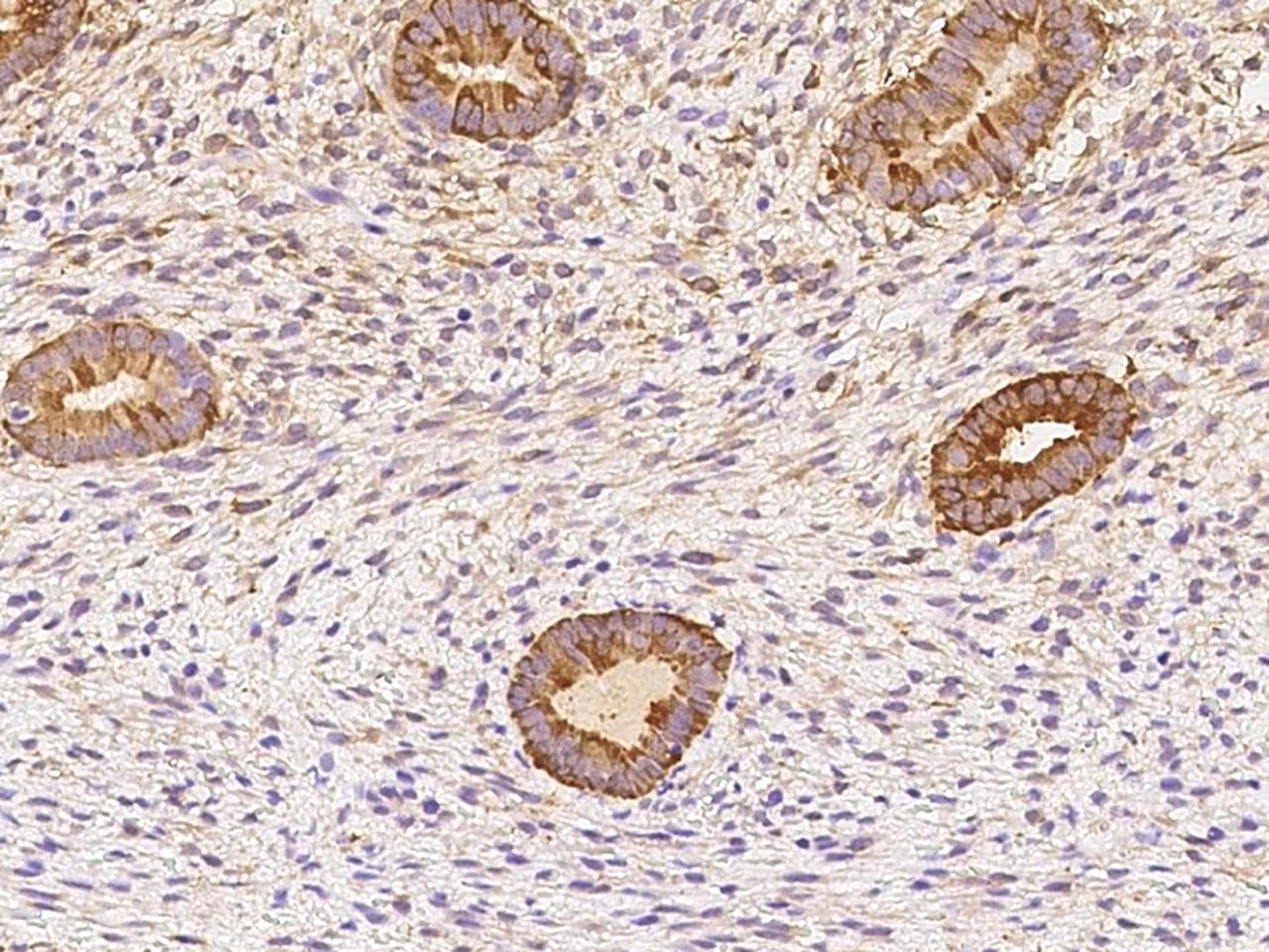 PHGDH Antibody