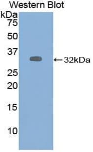 ALDOA / Aldolase A Antibody (aa18-273)