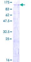 Human GPAM Protein (Recombinant GST)