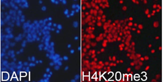 Polyclonal Rabbit anti-Human Histone H4 Antibody (Tri-Methyl-Lys20, IHC, IF, WB)