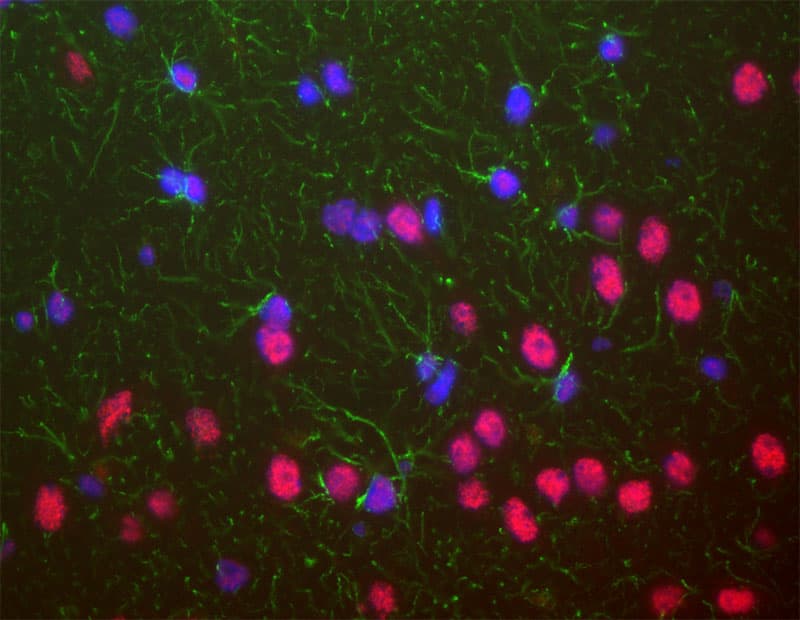 IHC-plus™ Monoclonal Mouse anti-Human TDP-43 / TARDBP Antibody (clone 3H8, IHC, IF, WB)